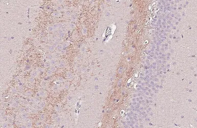 Anti-BACE1 antibody [HL5067] used in IHC (Paraffin sections) (IHC-P). GTX645257