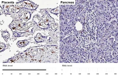 Anti-Factor XIIIa antibody [HL5069] used in IHC (Paraffin sections) (IHC-P). GTX645259