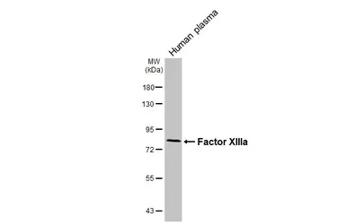 Anti-Factor XIIIa antibody [HL5069] used in Western Blot (WB). GTX645259