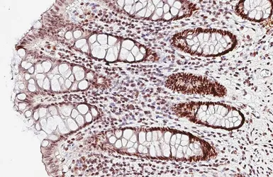 Anti-MSH6 antibody [HL5070] used in IHC (Paraffin sections) (IHC-P). GTX645260