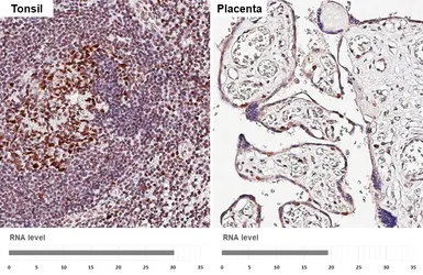 Anti-MSH6 antibody [HL5070] used in IHC (Paraffin sections) (IHC-P). GTX645260