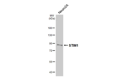 Anti-STIM1 antibody [HL5073] used in Western Blot (WB). GTX645263
