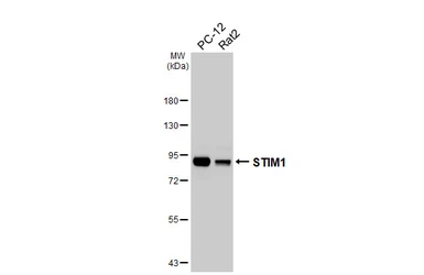 Anti-STIM1 antibody [HL5073] used in Western Blot (WB). GTX645263