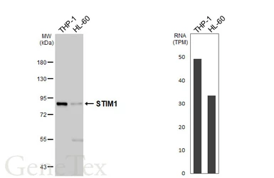 Anti-STIM1 antibody [HL5073] used in Western Blot (WB). GTX645263