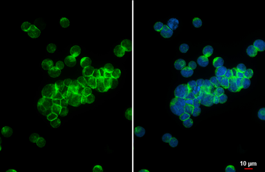 Anti-STIM1 antibody [HL5073] used in Immunocytochemistry/ Immunofluorescence (ICC/IF). GTX645263