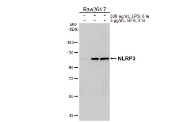 Anti-NLRP3 antibody [HL5077] used in Western Blot (WB). GTX645267