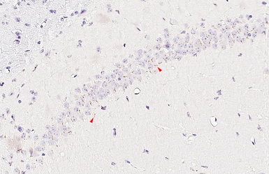 Anti-MCH-1R antibody [HL5082] used in IHC (Paraffin sections) (IHC-P). GTX645272