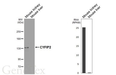 Anti-CYFIP2 antibody [HL5085] used in Western Blot (WB). GTX645275