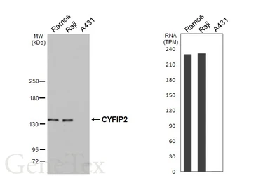 Anti-CYFIP2 antibody [HL5085] used in Western Blot (WB). GTX645275