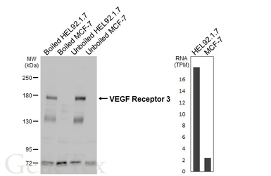 Anti-VEGF Receptor 3 antibody [HL5094] used in Western Blot (WB). GTX645284