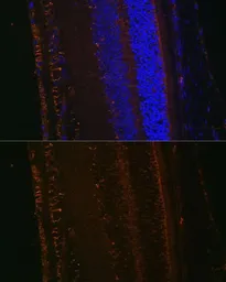 Anti-LOXL1 antibody used in IHC (Paraffin sections) (IHC-P). GTX64529