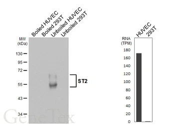 Anti-ST2 antibody [HL5099] used in Western Blot (WB). GTX645293