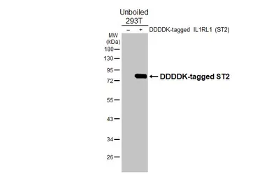 Anti-ST2 antibody [HL5099] used in Western Blot (WB). GTX645293