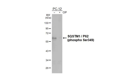Anti-SQSTM1 / P62 (phospho Ser349) antibody [HL5102] used in Western Blot (WB). GTX645296