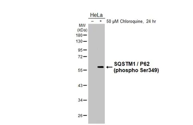 Anti-SQSTM1 / P62 (phospho Ser349) antibody [HL5102] used in Western Blot (WB). GTX645296