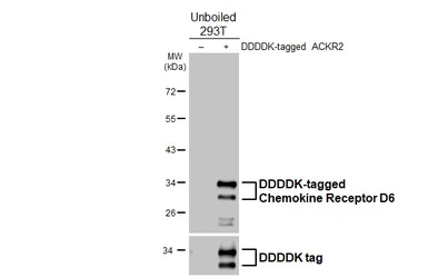 Anti-Chemokine Receptor D6 antibody [HL5104] used in Western Blot (WB). GTX645298