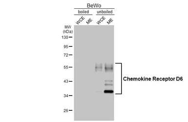 Anti-Chemokine Receptor D6 antibody [HL5104] used in Western Blot (WB). GTX645298