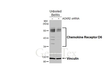 Anti-Chemokine Receptor D6 antibody [HL5104] used in Western Blot (WB). GTX645298