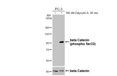 Anti-beta Catenin (phospho Ser33) antibody [HL5105] used in Western Blot (WB). GTX645299