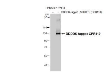 Anti-GPR110 antibody [HL5109] used in Western Blot (WB). GTX645303