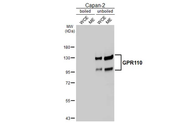 Anti-GPR110 antibody [HL5109] used in Western Blot (WB). GTX645303