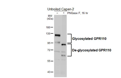 Anti-GPR110 antibody [HL5109] used in Western Blot (WB). GTX645303