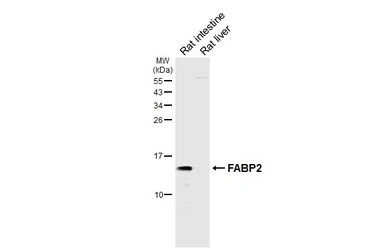 Anti-FABP2 antibody [HL5114] used in Western Blot (WB). GTX645308