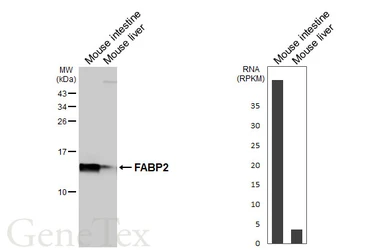 Anti-FABP2 antibody [HL5114] used in Western Blot (WB). GTX645308