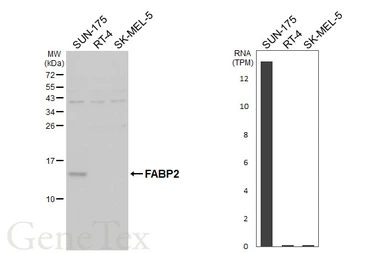 Anti-FABP2 antibody [HL5114] used in Western Blot (WB). GTX645308