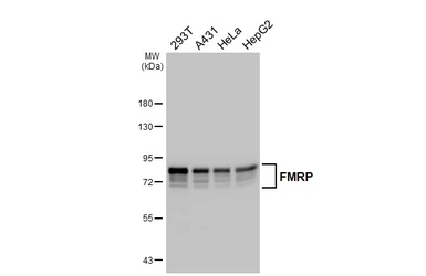 Anti-FMRP antibody [HL5117] used in Western Blot (WB). GTX645311