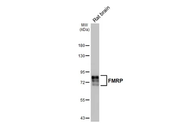 Anti-FMRP antibody [HL5117] used in Western Blot (WB). GTX645311