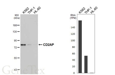 Anti-CD2AP antibody [HL5122] used in Western Blot (WB). GTX645318