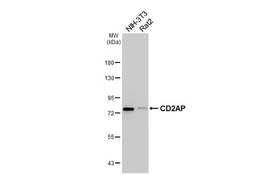 Anti-CD2AP antibody [HL5122] used in Western Blot (WB). GTX645318