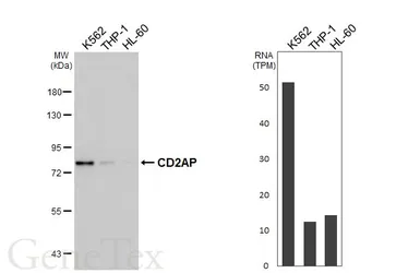 Anti-CD2AP antibody [HL5122] used in Western Blot (WB). GTX645318