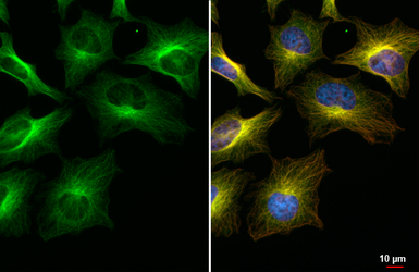 Anti-beta Tubulin antibody [HL5123] used in Immunocytochemistry/ Immunofluorescence (ICC/IF). GTX645319