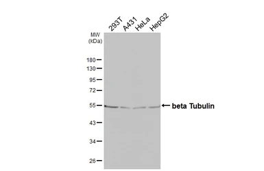 Anti-beta Tubulin antibody [HL5123] used in Western Blot (WB). GTX645319