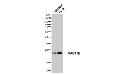 Anti-RAB11B antibody [HL5138] used in Western Blot (WB). GTX645334