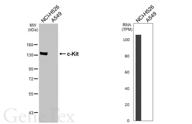 Anti-c-Kit antibody [HL5146] used in Western Blot (WB). GTX645342