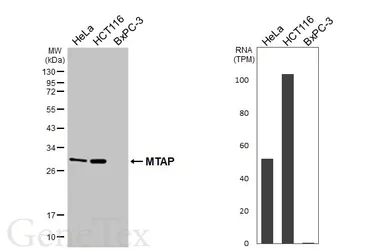 Anti-MTAP antibody [HL5147] used in Western Blot (WB). GTX645343