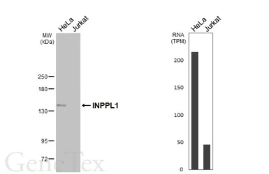 Anti-INPPL1 antibody [HL5150] used in Western Blot (WB). GTX645346