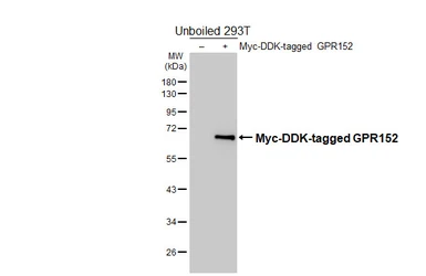 Anti-GPR152 antibody [HL5168] used in Western Blot (WB). GTX645364