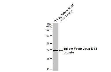 Anti-Yellow Fever virus NS3 protein antibody [GT341] used in Western Blot (WB). GTX645370