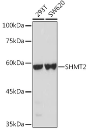 Anti-SHMT2 antibody used in Western Blot (WB). GTX64542