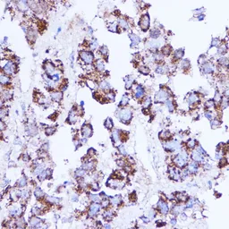Anti-SHMT2 antibody used in IHC (Paraffin sections) (IHC-P). GTX64542