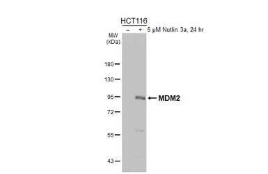 Anti-MDM2 antibody [HL5170] used in Western Blot (WB). GTX645422