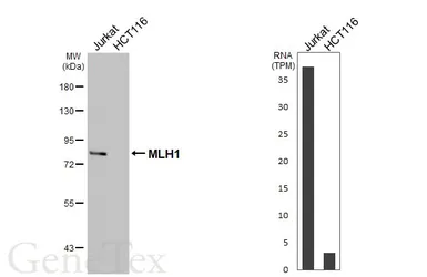 Anti-MLH1 antibody [HL5175] used in Western Blot (WB). GTX645427