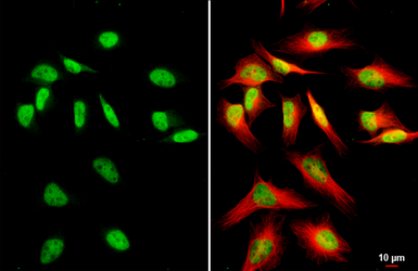 Anti-MLH1 antibody [HL5175] used in Immunocytochemistry/ Immunofluorescence (ICC/IF). GTX645427