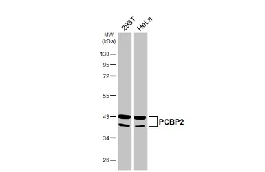 Anti-PCBP2 antibody [HL5177] used in Western Blot (WB). GTX645429