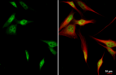 Anti-PCBP2 antibody [HL5177] used in Immunocytochemistry/ Immunofluorescence (ICC/IF). GTX645429