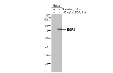 Anti-EGR1 antibody [HL5183] used in Western Blot (WB). GTX645435